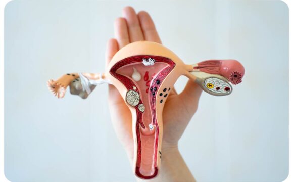 Рецидив вагінального пролапсу після гістеректомії